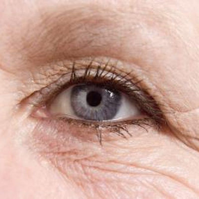 Purchasing an eye cream – The facts you need to know